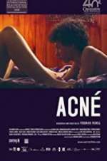 Watch Acné Putlocker